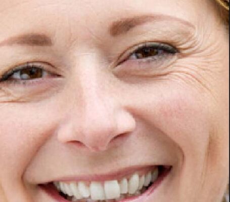 Smile