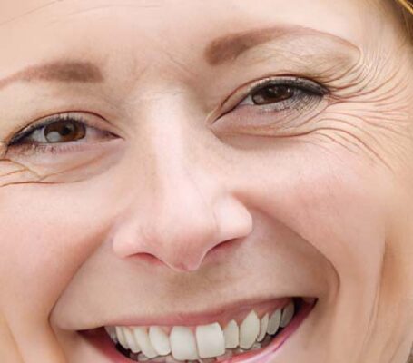 Smile-G Smile-G